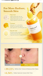 Medicube Tónico Facial con Ácido Kójico y Cúrcuma 250 ml