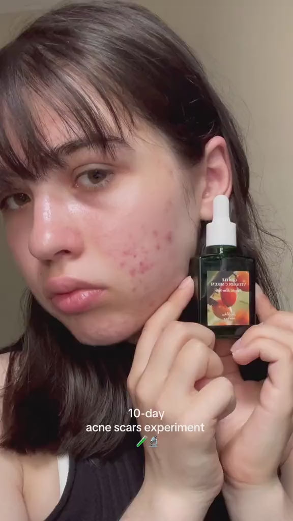 DR. ALTHEA Serum suave con vitamina C 20%.